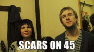 Scars On 45 backstage at The Brudenell Social Club